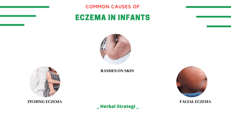 Common Causes Of Eczema In Infants